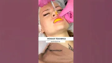 Апельсин во рту для ровного увеличения губ